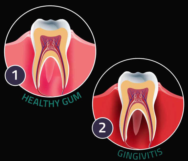 Periodontist Toronto | Gum Specialist | Dr. Jon Perlus